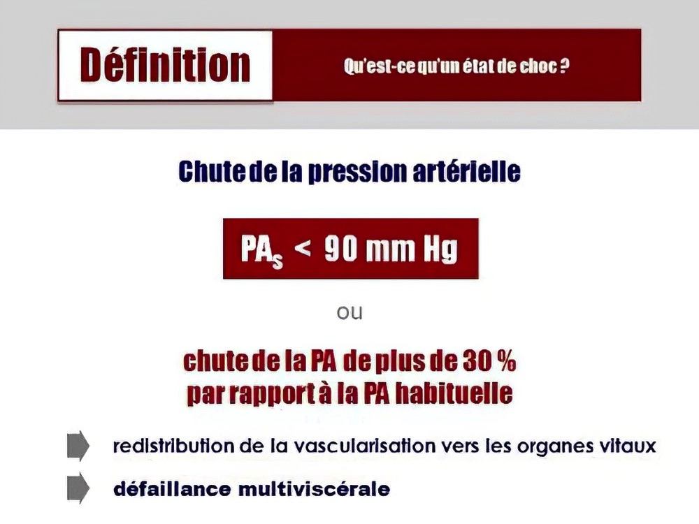 Choc anaphylactique urgence cabinet dentaire